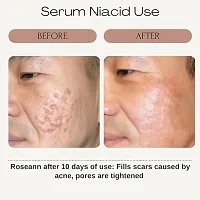 Niacid Face Serum 50 ml-thumb3