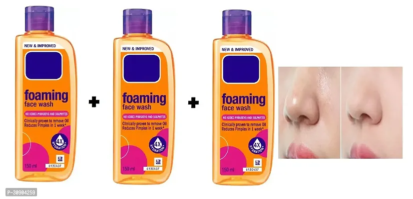 New improved oily skin foaming facewash 150ml pack of 03.