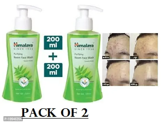 Himalayan neem face wash 200ml pack of 2