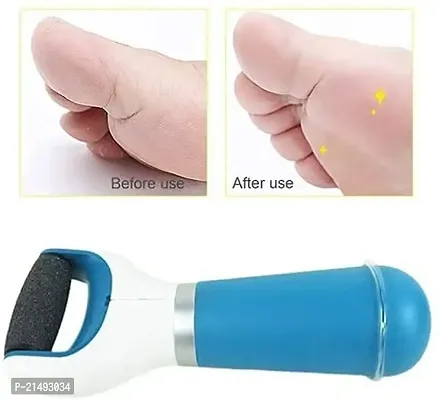 EBOFAB Pedicure Tool Foot Scrubber for Dead Skin Electronic Callus Remover Cracked Heels Removerfor men And Women(Multicolour)-thumb4