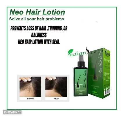 NEO HAIR LOTION 120ML FOR MAN AND WOMEN-thumb0