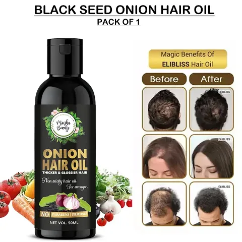 Onion Hair Oil , Hair Fall Control, Hair Growth oil, hair oil,olive oil for hair growth,pure castor oil,sweet almond oil,onion oil for hair,onion oil,bal ugane wala tel,adivasi hair oil,bal badhane ki