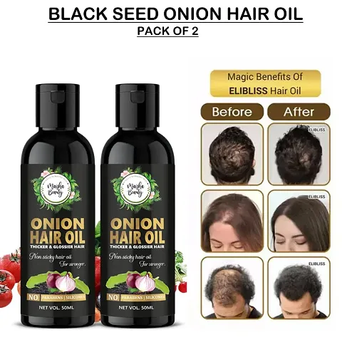 Onion Hair Oil , Hair Fall Control, Hair Growth oil, hair oil,olive oil for hair growth,pure castor oil,sweet almond oil,onion oil for hair,onion oil,bal ugane wala tel,adivasi hair oil