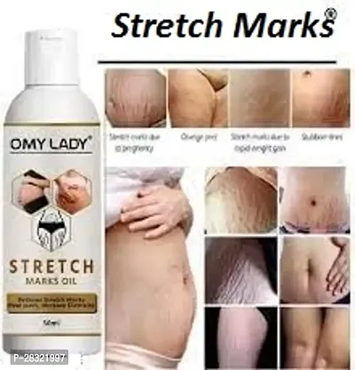 Lady Stretch Marks Removal Oil Pack Of 2-thumb2