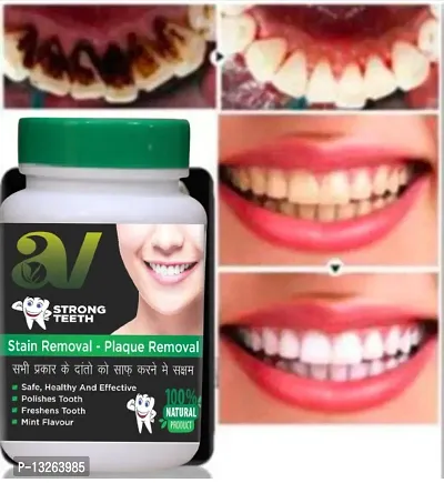 Teeth Whitening, Stain Removal