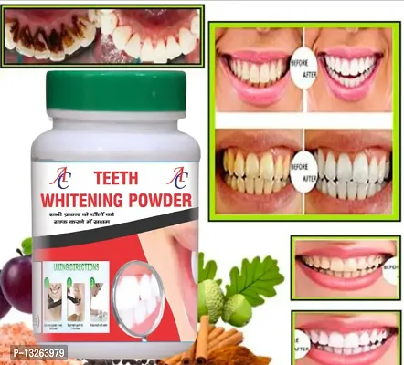 Teeth Whitening, Stain Removal