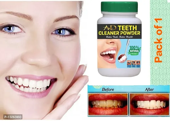 Teeth Whitening, Stain Removal