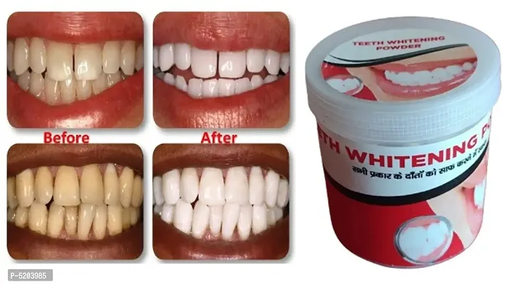 Teeth Whitening Powder 100% Natural-thumb0