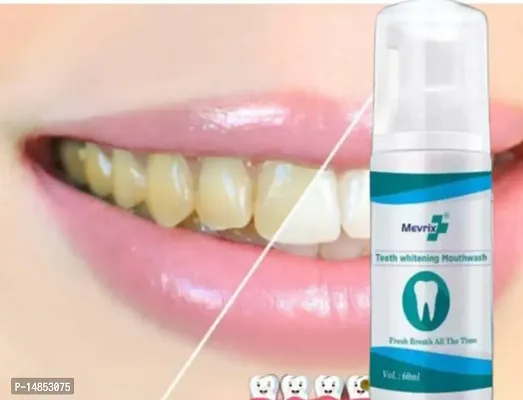Teeth Whitening Toothpaste Foam for Healthy and Gum Free Teeth 100% Natural No Side Effects-thumb0