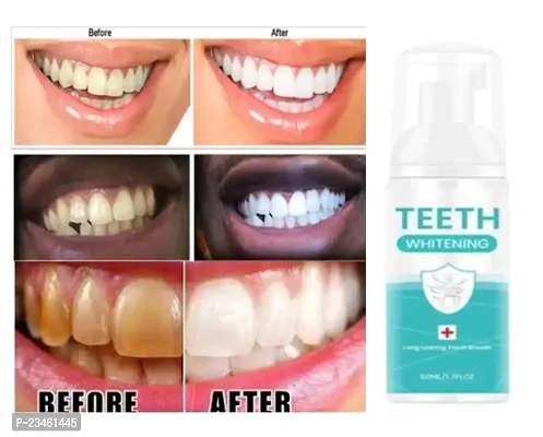 Tooth Foam For Teeth Cleaning | Powered By Hyaluronic Acid|Fluoride, Alcohol, SLS  Paraben Free Vegan Tooth Foam|Travel-Friendly Combination Of ToothpasteMouthwash-60ml-thumb0