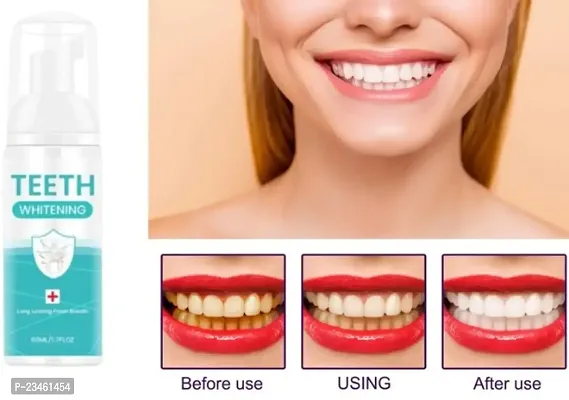 Tooth Foam For Teeth Cleaning | Powered By Hyaluronic Acid|Fluoride, Alcohol, SLS  Paraben Free Vegan Tooth Foam|Travel-Friendly Combination Of ToothpasteMouthwash-60ml