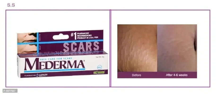 mederma scar free cream pack of 1 10Gm-thumb0