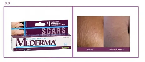 Mederma Scar Free Cream