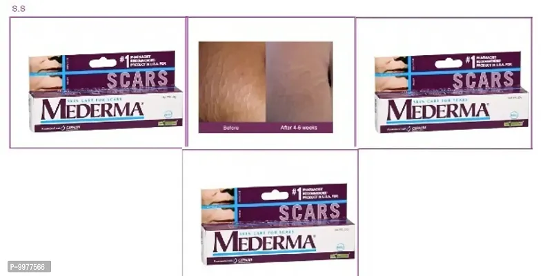 mederma scar free cream pack of 1 10Gm