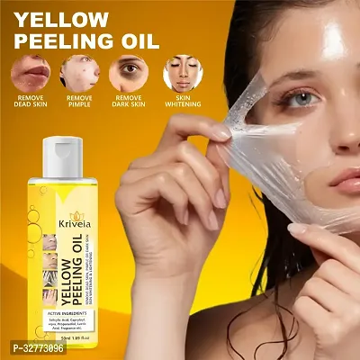 Yellow Peeling Oil - Deep Exfoliating Oil for Best Treatment for Acne-thumb0