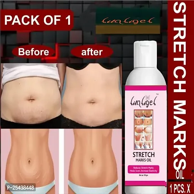 litaligel present stretch marks oil  Marks Removal - Natural Heal Pregnancy Breast, Hip, Legs, Mark oil Stretch Marks And Scars Creams  Oils 50 ml pack of 1