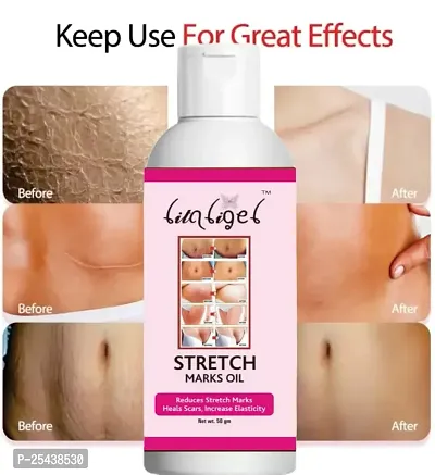 STRETCH  Marks Removal Litaligel - Natural Heal Pregnancy Breast, Hip, Legs, Mark oil Stretch Marks And Scars Creams  Oils 50 ml pack of 1