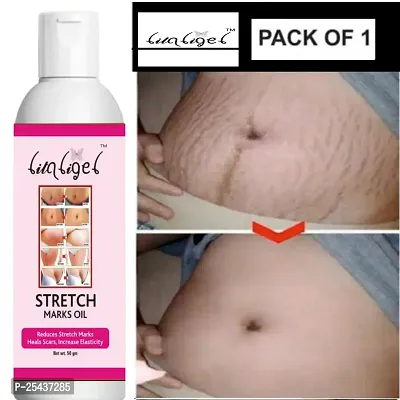 present Repair Stretch Marks Removal - Natural Heal Pregnancy Breast, , Legs, Mark oil 50 ml pack of 1 Stretch marks oil Litaligel-thumb0