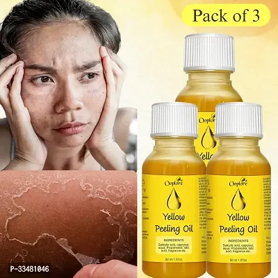 Ooplore Whitening Yellow Peeling Oil for Full Body Brighteninig  50 ml ( Pack of 3)-thumb0