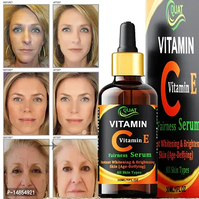 20% Vitamin C with Vitamin E Face Serum for Smoother  Brighter Skin Age Defying Whitening Serum (30 ml)-thumb0