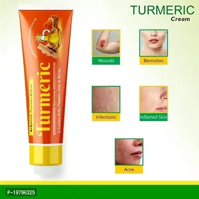 UNIQUE PROFESSIONAL ANTI ACNE  PIMPLE REMOVAL TURMERIC FACE CREAM 30 GR PACK OF 5-thumb4