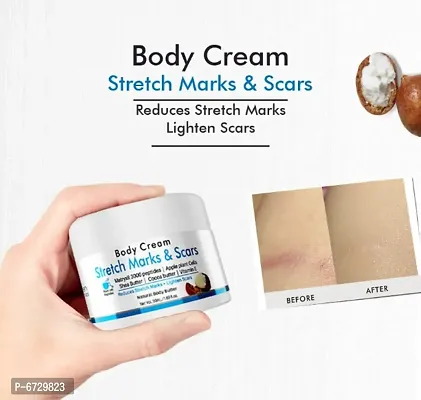 Stretch marks and Scars remover Body Cream with shea butter 50 ml