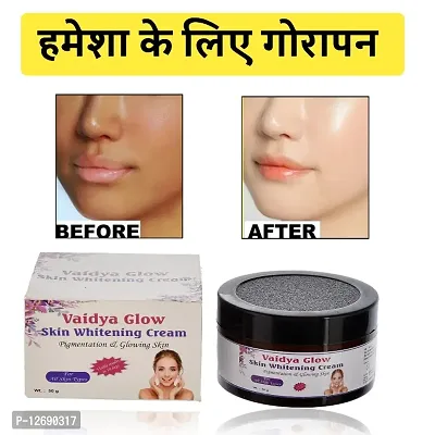 Vaidyaglow Skin Whitening Cream