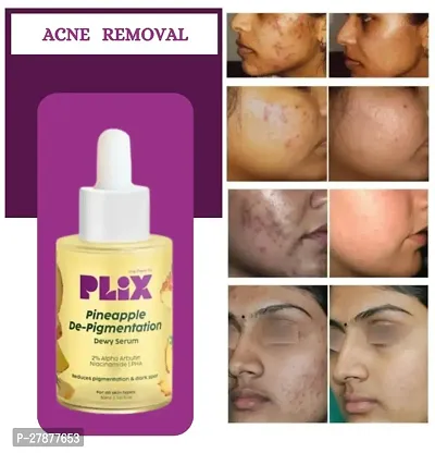 Plix Pineapple De-Pigmentation Dewy Face Serum For Men Women - 30 Ml-thumb0