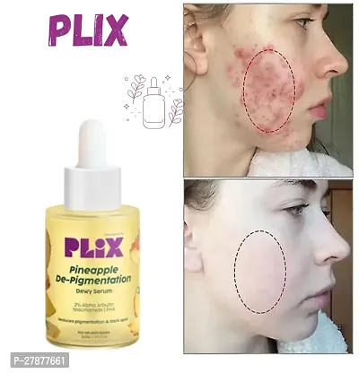 Plix Pineapple De-Pigmentation Dewy Face Serum For Men Women - 30 Ml