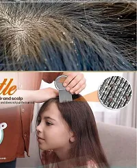 Long Lice Comb | combs with Stainless steel teeth for Head Lice, Nit  Egg Removal with Long Fine Metal Teeth (Multicolour) Plastic Handle Brush- For Kids, Women  Men-thumb2