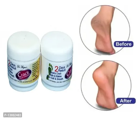 7 Days feet crack heel repair cream Smooth Foot Crack Cracked Heel Repair Foot Cream  (100 g)