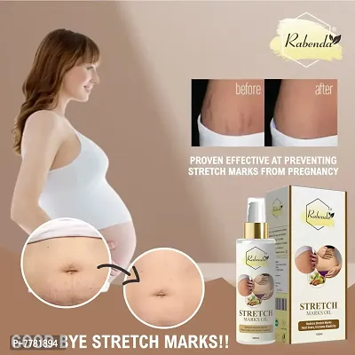 Rabenda Present Repair Stretch Marks Removal - Natural Heal Pregnancy Breast, Hip, Legs, Mark Oil - 100 ml-thumb2