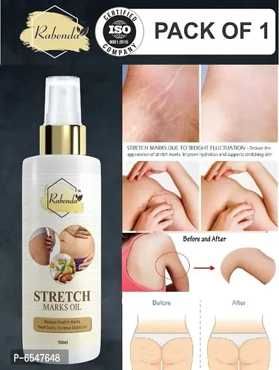 Rabenda present Repair Stretch Marks Removal - Natural Heal Pregnancy Breast, Hip, Legs, Mark oil 100 ml pack of 1