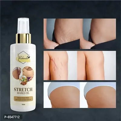 Rabenda present Repair Stretch Marks Removal - Natural Heal Pregnancy Breast, Hip, Legs, Mark oil 100 ml pack of 1-thumb4