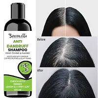 Professional Anti Dandruff Shampoo Enrich With Ginger, Lemon  Curry Leaf For Scalp Itchiness, Flaking And Dandruff Control- 100ml-thumb4