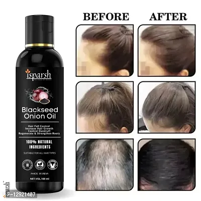 Onion Blackseed Hair oil For Hair Fall Control | onion oil | Bhringraj hair oil | Hair Growth Oil | adivasi herbal oil | red onion hair oil | olive oil | coconut oil | castor oil | sesame oil 100 ml