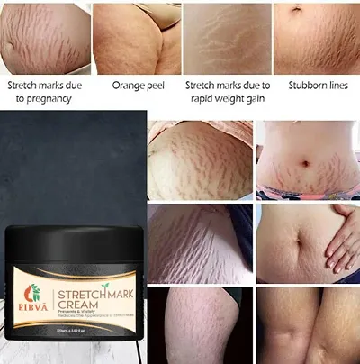 RIBVA Present Stretch Marks Removal Cream