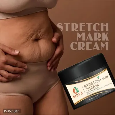 RIBVA present Stretch Marks Removal Cream - Natural Heal Pregnancy, Hip, Legs, Mark Cream 100 ml pack of 1