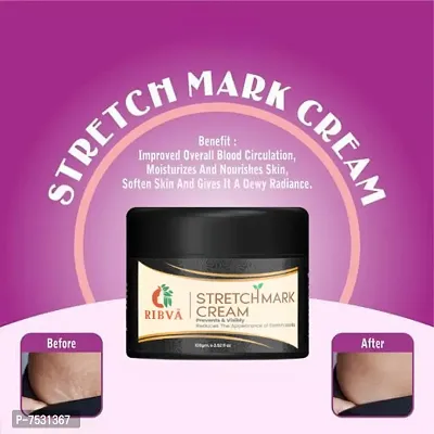 RIBVA present Stretch Marks Removal Cream - Natural Heal Pregnancy, Hip, Legs, Mark Cream 100 ml pack of 1-thumb3