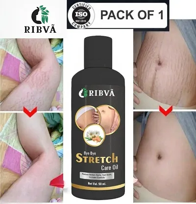 Hot Selling Anti-stretch Mark Creams 