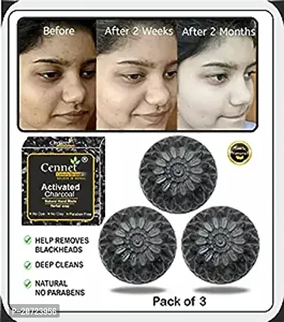 Activated Charcoal Soap For Skin Whitening, Natural Detox, Deep Cleaning, Skin Care Soap(3X100G) Pack Of 3