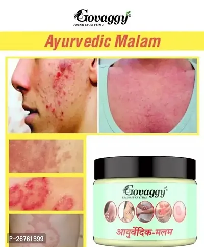 New Ayurvedic Malam for Ringworm, itching, Eczema  Fungal Infection-thumb0