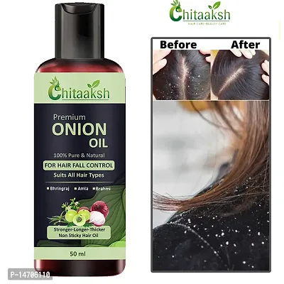 Hair Oil Black Seed Hair Oil  Hair Fall Control Hair Oil 50ml PACK OF 1.-thumb0