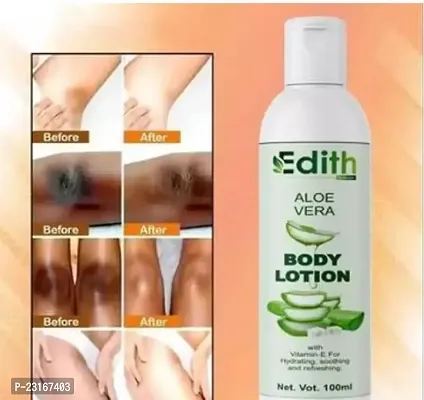 Natural Aloe Vera Gel Face Moisturizer Whitening Anti Wrinkle Cream Acne Scar Skin Sunscreen Acne Treatment Skin Care Pack Of 1