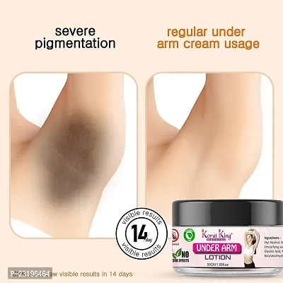 Skin Lightening Cream, Underarm Whitening Cream, Skin Sunscreen, Bleaching Cream, Whitening Cream, Arm Guard, Elbow Guard Body Lotion, Moisturizing Whitening Body Cream
