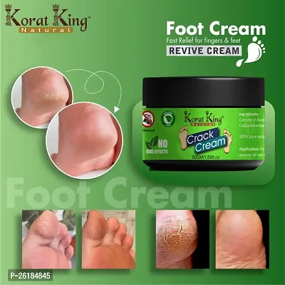 Crack cream 50GM pack of- 1-thumb4