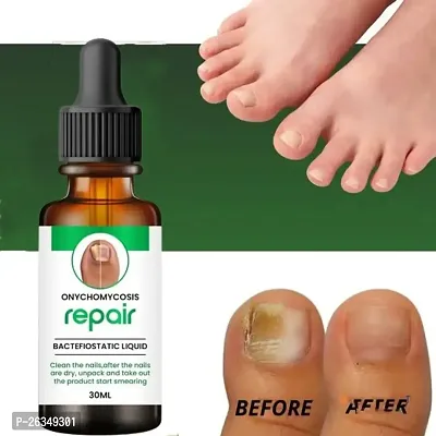 Nail Repair oil Nail Growth oil 30ml