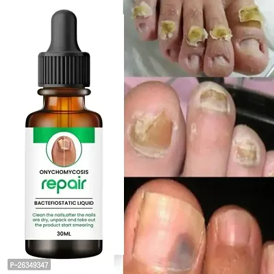 Nail Repair oil Nail Growth oil 30ml