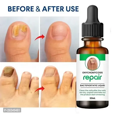 Nail Cuticle Oil For Nails Growth And Strength-thumb0