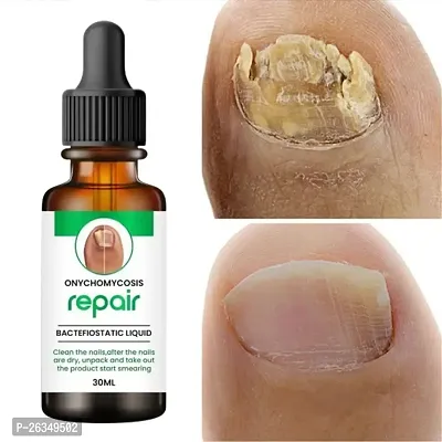 Nail Cuticle Oil For Nails Growth And Strength